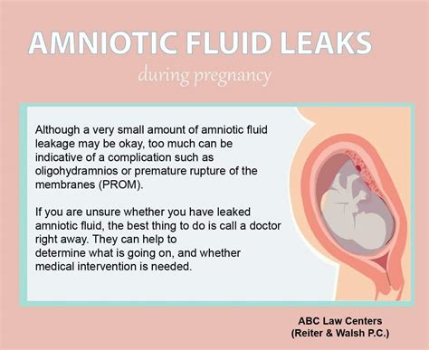 leaking amniotic fluid look like|Water Breaking: What Are the Signs of Leaking。